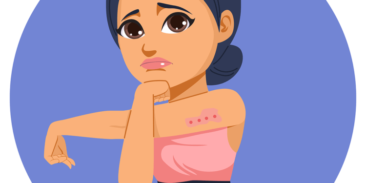 bed bug bites on female illustration