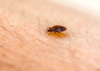 bed bug on skin