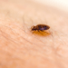 bed bug on skin