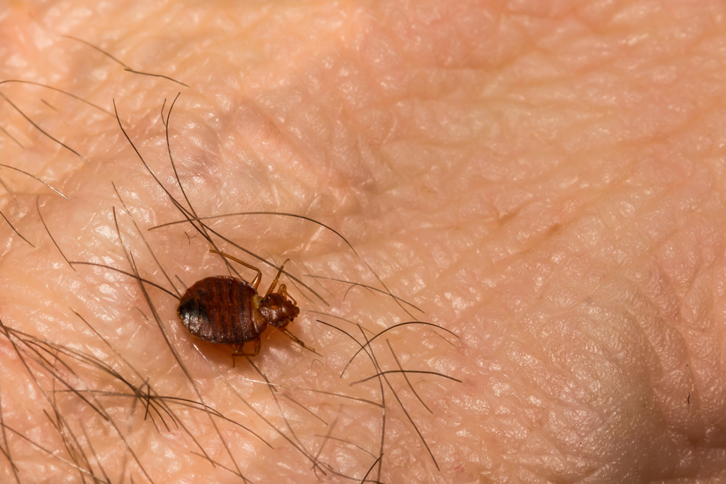 bed bug on skin